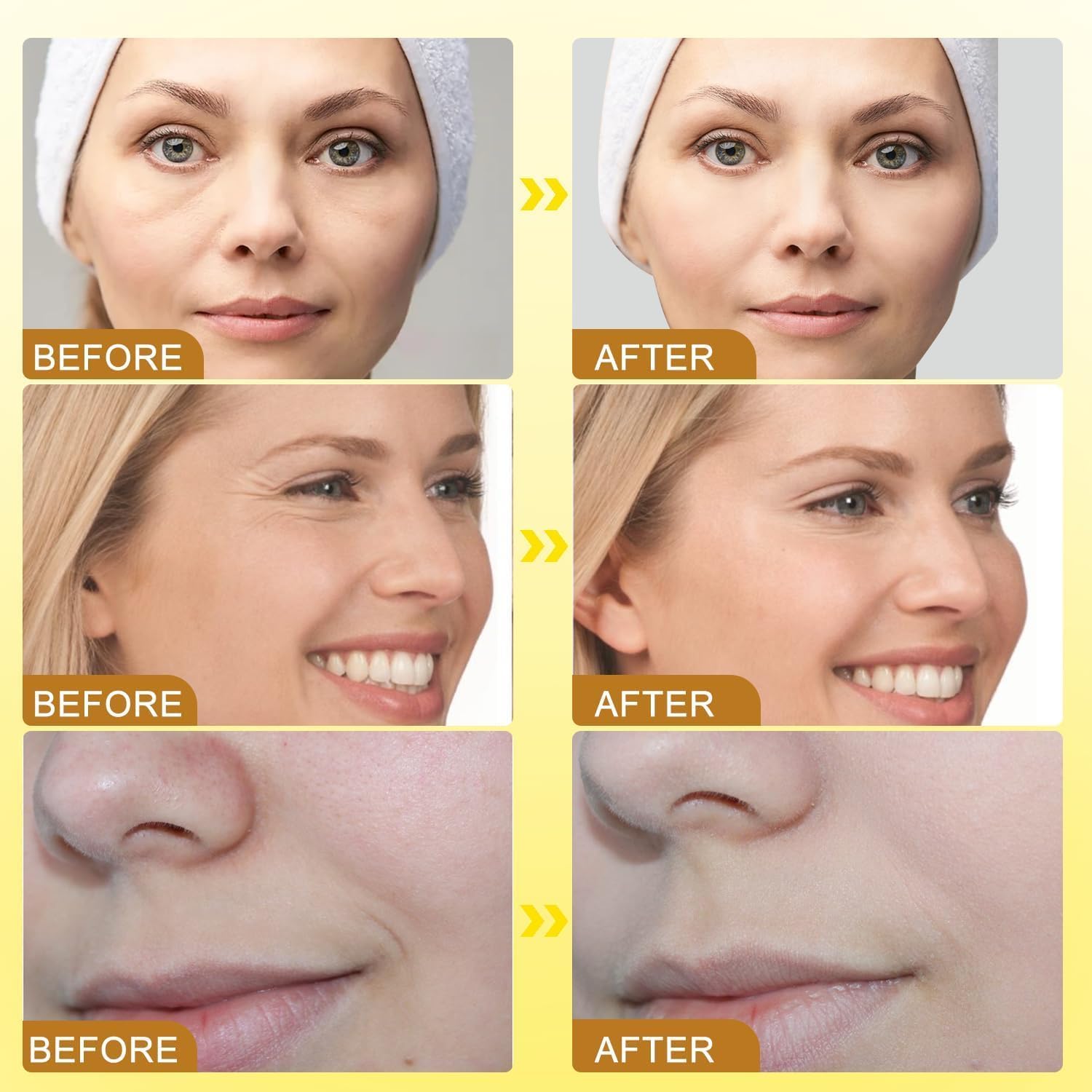 Botox Bee Venom Wrinkle Removal Cream